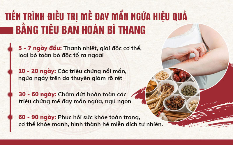 Tiến trình chữa nổi mề đay dứt điểm cùng bài thuốc Tiêu Ban Hoàn Bì Thang